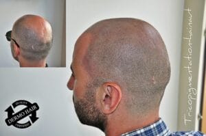 micropigmentation belgique