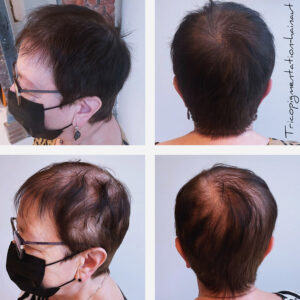 Avant / après d'un effet densité femme réalisé au centre micropigmentation hainaut